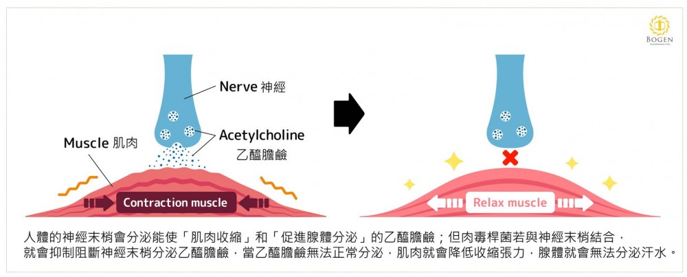 肉毒瘦肩原理,肉毒瘦肩,博恩妍